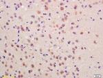 SOCS3 Antibody in Immunohistochemistry (Paraffin) (IHC (P))