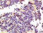SOCS3 Antibody in Immunohistochemistry (Paraffin) (IHC (P))