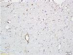 VWF Antibody in Immunohistochemistry (Paraffin) (IHC (P))