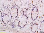 Adiponectin Receptor 1 Antibody in Immunohistochemistry (Paraffin) (IHC (P))