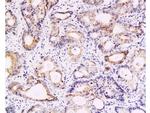 Survivin Antibody in Immunohistochemistry (Paraffin) (IHC (P))