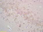 gamma Synuclein Antibody in Immunohistochemistry (Paraffin) (IHC (P))