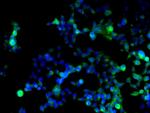 Cyclin D1 Antibody in Immunocytochemistry (ICC/IF)