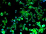 Cyclin D1 Antibody in Immunocytochemistry (ICC/IF)