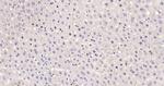 Cyclin D1 Antibody in Immunohistochemistry (Paraffin) (IHC (P))