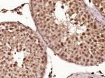 Cyclin D1 Antibody in Immunohistochemistry (Paraffin) (IHC (P))