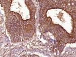 Cyclin D1 Antibody in Immunohistochemistry (Paraffin) (IHC (P))