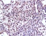 Cyclin D1 Antibody in Immunohistochemistry (Paraffin) (IHC (P))