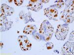 Cyclin D1 Antibody in Immunohistochemistry (Paraffin) (IHC (P))