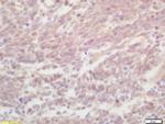 ZNF268 Antibody in Immunohistochemistry (Paraffin) (IHC (P))