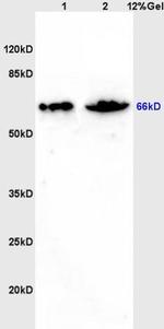 ZNF300 Antibody in Western Blot (WB)
