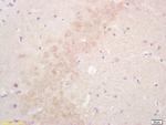 Estrogen Sulfotransferase Antibody in Immunohistochemistry (Paraffin) (IHC (P))