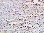 CDK4 Antibody in Immunohistochemistry (Paraffin) (IHC (P))