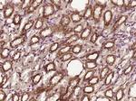 CDK4 Antibody in Immunohistochemistry (Paraffin) (IHC (P))