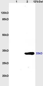 CDK4 Antibody in Western Blot (WB)