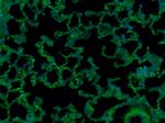 CD8 Antibody in Immunohistochemistry (Paraffin) (IHC (P))
