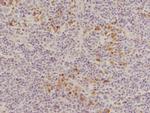 CD8 Antibody in Immunohistochemistry (Paraffin) (IHC (P))