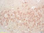 PAK7 Antibody in Immunohistochemistry (Paraffin) (IHC (P))