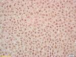 PAK7 Antibody in Immunohistochemistry (Paraffin) (IHC (P))