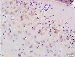 MRP1 Antibody in Immunohistochemistry (Paraffin) (IHC (P))