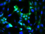 c-Jun Antibody in Immunocytochemistry (ICC/IF)