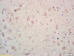 MCK10 Antibody in Immunohistochemistry (Paraffin) (IHC (P))