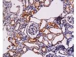 c-Kit Antibody in Immunohistochemistry (Paraffin) (IHC (P))