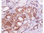 B7H4 Antibody in Immunohistochemistry (Paraffin) (IHC (P))