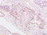 B7H4 Antibody in Immunohistochemistry (Paraffin) (IHC (P))