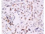 B7H4 Antibody in Immunohistochemistry (Paraffin) (IHC (P))
