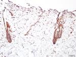 FGFR2 Antibody in Immunohistochemistry (Paraffin) (IHC (P))