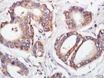 FGFR2 Antibody in Immunohistochemistry (Paraffin) (IHC (P))