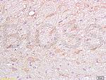 FGFR4/CD334 Antibody in Immunohistochemistry (Paraffin) (IHC (P))
