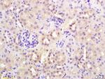 SYVN1 Antibody in Immunohistochemistry (Paraffin) (IHC (P))