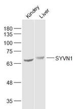 SYVN1 Antibody in Western Blot (WB)