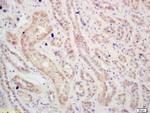 IGF1R Antibody in Immunohistochemistry (Paraffin) (IHC (P))