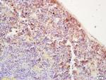 IGF1R Antibody in Immunohistochemistry (Paraffin) (IHC (P))