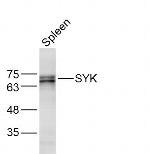 SYK Antibody in Western Blot (WB)