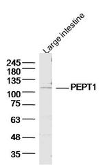 PEPT1 Antibody in Western Blot (WB)