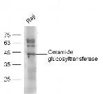 Ceramide glucosyltransferase Antibody in Western Blot (WB)