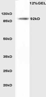 LDL receptor Antibody in Western Blot (WB)