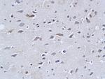 Neurofilament H Antibody in Immunohistochemistry (Paraffin) (IHC (P))