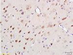 Neurofilament H Antibody in Immunohistochemistry (Paraffin) (IHC (P))
