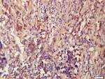 Tubulin-Beta 3 Antibody in Immunohistochemistry (Paraffin) (IHC (P))