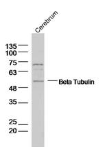 Tubulin-Beta 3 Antibody in Western Blot (WB)