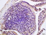 CIDEB Antibody in Immunohistochemistry (Paraffin) (IHC (P))