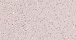 Smad2 Antibody in Immunohistochemistry (Paraffin) (IHC (P))