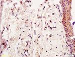 Smad2 Antibody in Immunohistochemistry (Paraffin) (IHC (P))