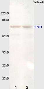 Estrogen Receptor alpha Antibody in Western Blot (WB)
