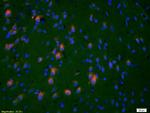 HSP27 Antibody in Immunohistochemistry (Paraffin) (IHC (P))